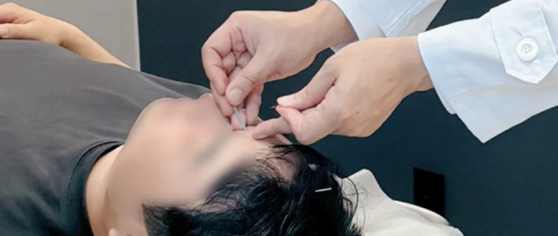 01. 침 치료 프로그램 이미지